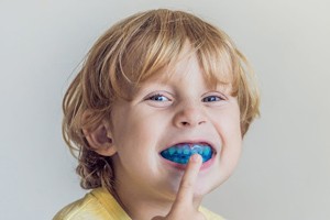 Orthodontie fonctionnelle LDM