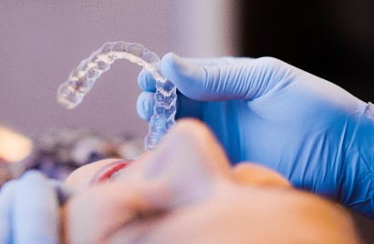 traitement orthodontique Saint Gely du Fesc